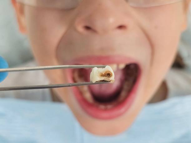 Best Broken Tooth Emergency  in Prospect, OH